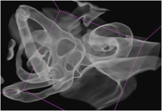 Zum Artikel "Radiologie heute: Organisation: RIS/PACS Spracherkennung / Bildverarbeitung: vom Schnittbild zum 3D-Objekt"